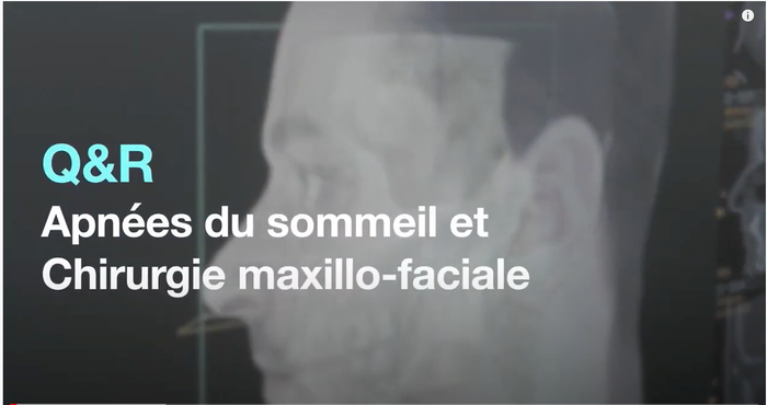 Apnées du sommeil et chirurgie maxillo-faciale : Ce qu'il faut savoir