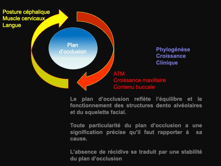 Les 3 causes de récidive après une opération des mâchoires
